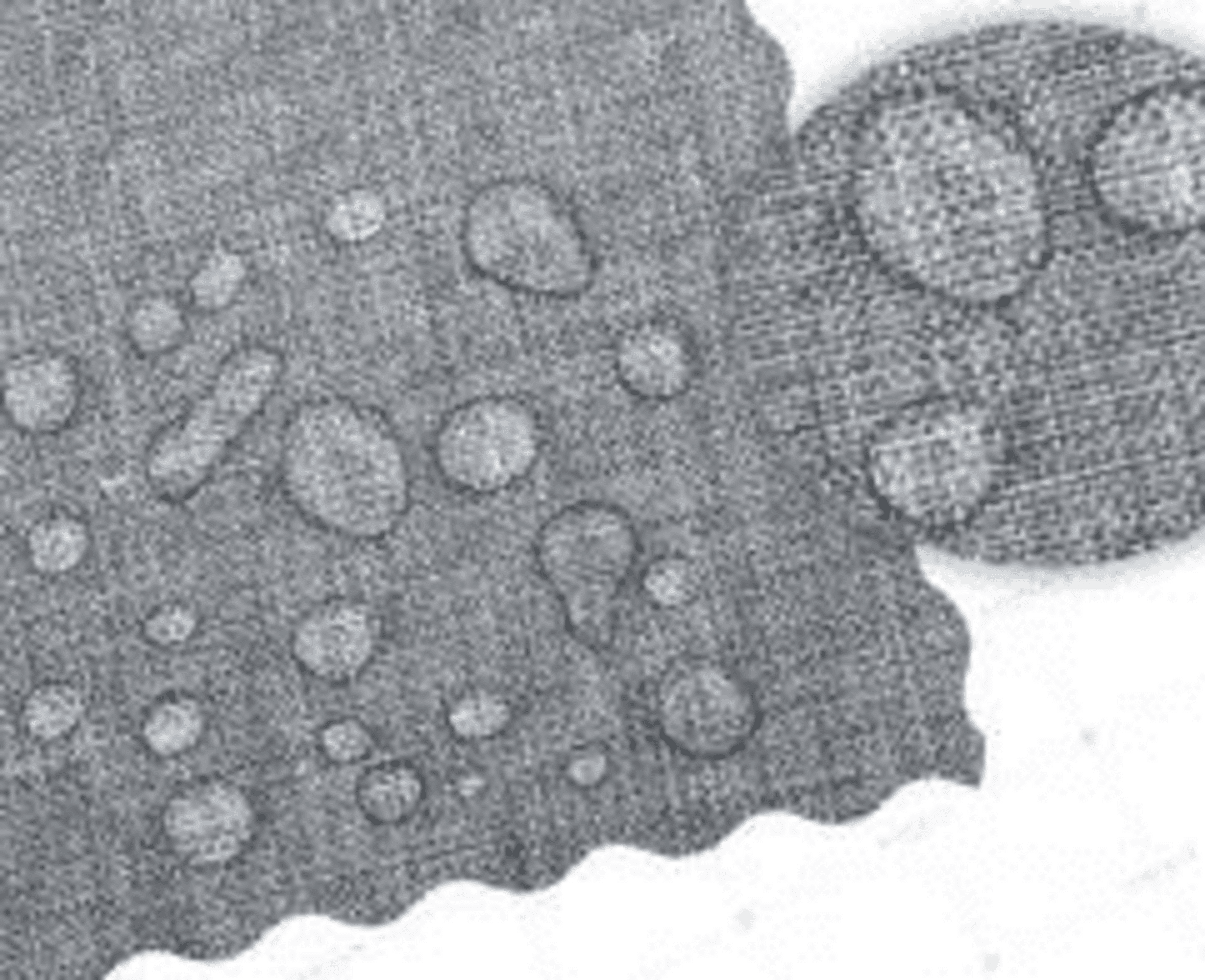 Babestu® LINO - 3